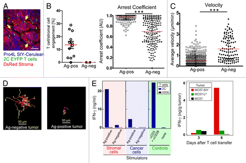 Figure 4. Antigen-dependent stromal engagement of 2C-EYFP CD8+ T cells in Pro4L-SIY-Cerulean tumors (A–D). T cells interact with DsRed-positive stromal cells (yellow arrows); scale bar = 75μm. Image corresponds to Video 8. (B) Left panel. Stromal engagement of T cells is antigen-dependent. Percentage of T cell/stromal cell engagements in Pro4L-SIY-Cerulean (Ag-positive) and Pro4L-Cerulean (Ag-negative) tumors. See Methods for further details. Right panel, Arrest coefficient, (C) average velocities, and (D) representative displacement tracks for 2C T cells in antigen-positive Pro4L-SIY and antigen-negative Pro4L control tumors are graphed (scale bar = 50μm). Red lines indicate mean; black bars indicate td-StDev. Data are representative of 3 experiments and mice, 2 with Pro4L-SIY tumors and 1 with Pro4L. A total of 12 movies (Pro4L-SIY) and 3 movies (Pro4L) were analyzed, 30–150 min long. In B and C, each dot represents an individual T cell. P values were obtained with Mann–Whitney analysis for (B–D); ***P < 0.0001. (E) Left panel: IFNγ secretion by 2C T cells stimulated with tumor-derived stromal cells or cancer cells. CD11b+ stromal cells were isolated from established antigen-positive MC57-SIY tumors (or antigen-negative MC57-hgp100 tumors as control) by magnetic separation and co-cultured with peptide-activated 2C T cells. Stromal cells were compared with equal numbers of cultured cancer cells expressing the same antigen. Supernatants were harvested after 24 h of co-culture and IFNγ was measured by ELISA. Non-stimulated T cells served as negative control (none) and a Data are representative for 4 independent experiments. Right panel: High in vivo IFNγ levels in solid tumors after adoptive T cell transfer only when cross-presentation is enabled. Rag−/−mice with established MC57, MC57-Ld, or MC57-SIY tumors were treated with activated 2C T cells. Three and 6 d after T cell transfer, in vivo IFNγ levels were determined in homogenized tissues of individual tumors by ELISA as per manufacturer’s instructions (eBioscience). Bars represent IFNγ levels per gram of tumor tissue. Data are representative for 2 experiments with 3 to 5 tumors per group.