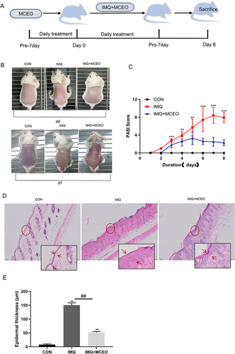 Figure 7 MCEO ameliorates psoriatic-like skin lesion in IMQ-induced mice. (A) Mice were pretreated with MCEO daily for seven consecutive days, followed by treatment with MCEO +IMQ daily for seven consecutive days and observation on day eight. (B) Photos of the dorsal skin of mice were captured on the eighth day after daily administration of IMQ+MCEO. (C) The cumulative PASI scores of all groups were also calculated daily. (D) H&E staining of the dorsal skin (magnification: 100×, 400×), the distance between the red arrows represents the acanthoderm thickness and (E) epidermal thickness of the dorsal skin on day eight (scale bar: 100 μm). Data are presented as mean ± SD (n=6), **P<0.01 and ***P<0.001 vs Psoriasis model group. ##P<0.01 vs IMQ+MCEO group. One representative of three separate experiments is shown.