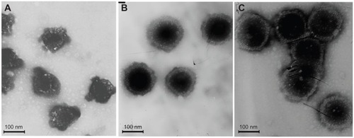 Figure 4 Transmission electron microscopic imaging of cationic liposome-coated deoxyribonucleic acid/protamine/deoxyribonucleic acid complexes with different mass ratios: (A) 25:1, (B) 50:1, (C) and 75:1.