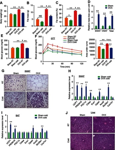 Figure 2 Ovariectomized females reduce adiposity, increase glucose tolerance and exhibit enhanced beiging following cold-exposure. Two-month-old female mice underwent sham operation or ovariectomy (OVX), 3 months later, both groups were either subjected to cold-exposure (6 °C) for 7 days or maintained at RT (23 °C). (A) Body weight, n≥11. (B) Fat mass by NMR, n≥6. (C) Fat content by NMR, n≥6. (D) Relative fat mass loss in SWAT and VWAT compartments of Sham and OVX females were calculated according to white adipose depot weights (see Figure S3B): SWAT = Cold (2*IGW + ISCW) – RT (2*IGW + ISCW); VWAT = Cold (2*PGW + 2*RPW +MWAT) – RT (2*PGW + 2*RPW + MWAT), n≥8. (E) Blood glucose levels of Sham and OVX females, n≥8. (F) Glucose tolerance tests were performed in Sham and OVX females at RT (a week prior to cold-exposure) and immediately after cold-exposure. Mice were fasted, i.p. injected with 1.25 g/kg glucose, and their glucose levels were monitored, n≥9. Inset – areas under curve. (G) Representative H&E-stained histological sections of SWAT, n≥8. (H–I) Relative mRNA levels, quantified by qPCR, of brown/beige adipocyte markers expressed in SWAT (IGW) (H) and BAT (I) at cold, n≥6. (J) Representative H&E-stained histological sections of the liver. Scale bars =100 µm. Error bars indicate S.E.M. Statistical significance assessed by two-tailed Student’s t-test, *p<0.05, **p<0.01, NS, not significant; and one-way ANOVA test, $p<0.01.