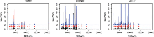 Figure 5. Three representative protein mass spectra (centered and normalized) from serum taken from patients with apparently healthy prostate, enlarged prostate, and prostate cancer. It would be useful to be able to predict disease status from the spectra. The red and blue spectra have been shifted upward by 5 and 10 units, respectively.