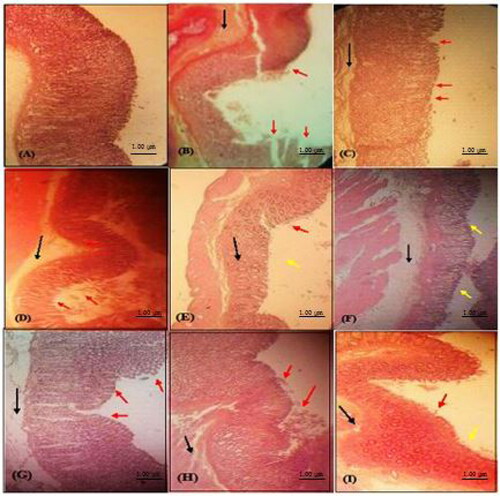 Figure 4. Histological examination of rat stomach (H & E stained) from different treatment groups: (A) Normal vehicle control group; (B) Ulcer control (ethanol 5 mL/kg) showing mucosal damage; (C) Standard drug (omeprazole treated; 20 mg/kg bw); (D) Compound 389 treated (20 mg/kg bw); (E) Compound 389 (40 mg/kg bw); (F) Compound 389 (60 mg/kg bw) showing normalization of morphological changes; (G) Compound 393 (20 mg/kg bw); (H) Compound 393 (40 mg/kg bw); (I) Compound 393 (60 mg/kg bw) showing normalization of morphological changes. Red arrow (disrupted epithelium), black arrow (oedema and neutrophil infiltration), yellow arrow (intact epithelium).