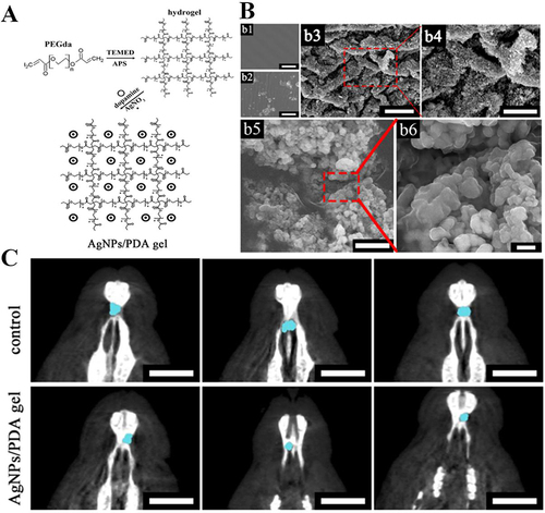 Figure 8 (A) The scheme of the preparation of AgNPs/PDA gel. (B) SEM images of PEGda gel without any coating on surface (b1), dopamine-coated PEGda gel (b2), and AgNPs/PDA gel (b3 and b4); The bars of (b1–b3) = 20 μm, the bar of (b4) = 10 μm, the bar of (b5) = 1 μm, the bar of (b6) = 200 nm. (C) The CT photos of the mice treated with AgNPs/PDA gel. The blue dots were the bone defects. Bar = 10 mm. Reprinted from Materials Science and Engineering: C, 90, Xu H, Zhang G, Xu K, et al, Mussel-inspired dual-functional PEG hydrogel inducing mineralization and inhibiting infection in maxillary bone reconstruction, 379–386, Copyright 2018, with permission from Elsevier.Citation90