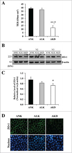 Figure 5. Cell integrity, transepithelial electrical resistance (TER) and expression of tight junction protein. (A): Tight junction barrier function was evaluated by TER measurement. (B): Expression level of ZO-1 was evaluated by Western blotting. (C): Intensity of ZO-1 band was measured and normalized with that of β-actin, which served as the loading control. (D): Expression and localization of ZO-1 was also examined by immunofluorescence staining. Original magnification was 400X in all panels. Each bar in (A) and (C) represents mean ± SD of 3 independent experiments. * = p < 0.05 vs. ANK; ** = p < 0.01 vs. ANK; # = p < 0.01 vs. ALK.