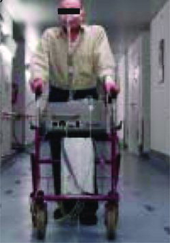 Figure 1. A chronic obstructive pulmonary disease patient during a 6-minute walking test while walking with a rollator [Reproduced by permission of Dr. Wolfram Windisch from Dreher et al. (Citation34)).