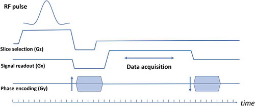 Figure 12. A sequence chart of a currently typical gradient echo sequence. Typical time step for the calculation for the RF pulse event is 10 μs and that for data acquisition is 10 μs