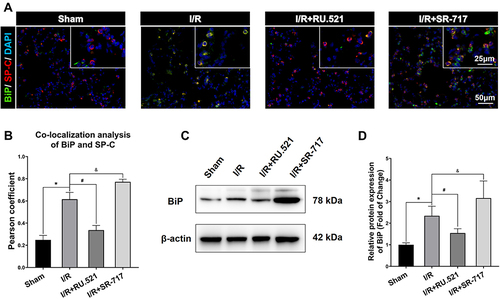 Figure 4 BiP expression in alveolar epithelial type II cells by using Western blot and double immunofluorescent staining respectively. (A) Double immunofluorescent staining to colocalize BiP with alveolar epithelial type II cells marker SP-C in lung tissue. Scale bar = 25μm or 50μm. (B) The quantified colocalization of BiP with alveolar epithelial type II cells marker was assessed using the Pearson coefficient. Data are presented as mean ± SEM, n = 6 per group. (C-D) Western blotting analysis to verify the expression of BiP. Data are presented as mean ± SEM, n = 3 per group. *P < 0.05 vs sham group, #P < 0.05 vs I/R group, &P < 0.05 vs I/R group.