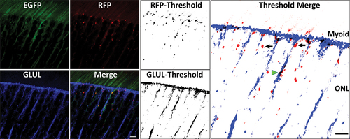 Figure 8. High magnification confocal microscopy image (40X objective, Zoom Factor 5X) of photoreceptor IS and cell body alongside immunohistochemistry against glutamine synthetase (GLUL), a marker of Müller glial cells. Thresholded images of red and far-red channels (corresponding to RFP and GLUL, respectively), and subsequent merger using ImageJ® software, demonstrated that several phagosomes were lined up in the IS-myoid along the external limiting membrane (ELM), and also were present in photoreceptor cell bodies (black arrows). Some phagosomes also colocalized in GLUL-positive Müller glial cells exclusive of GLUL-positive cellular processes (green arrowhead). Scale bar: 5 µm.
