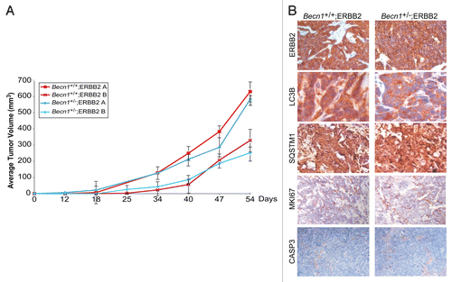 Figure 5. ERBB2-expressing Becn1+/+ and Becn1+/− iMMECs have similar tumor-forming capacities in nude mice. (A) Independent ERBB2-overexpressing Becn1+/+ and Becn1+/− iMMEC lines (e.g., A and B) were bilaterally implanted into the 3rd mammary fat pads of nude mice. Mice were monitored for tumor growth. Each data point represents the average volume of iMMEC-generated mammary tumors in 5 mice (2 tumors per mouse) per genotype ± SD (B) Representative images of ERBB2, LC3B, SQSTM1, MKI67, and cleaved CASP3 expression, as determined by IHC, in ERBB2-expressing Becn1+/+ (Becn1+/+;ERBB2) and ERBB2-expressing Becn1+/− (Becn1+/−;ERBB2) iMMEC-generated allograft mammary tumors from (A).