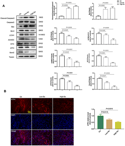 Figure 2 Solanine deactivates the AAMDC pathway of autophagy and promotes apoptosis in vivo. (A) Western blotting analysis showing the protein expression of cleaved Caspase-3, Bax, Bcl-2, LC3, AAMDC, MYC, ATF4 and Sesn2. (B) The expression levels of ATF4 were determined using immunofluorescent microscopy. Data are expressed as the mean ± SD (n=3).