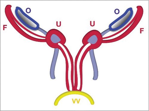 FIGURE 3. Schematic Stage of Duplicated Uterus. The uterus (U) and vagina (V) are duplicated before fusion. The uterus is detected in the crossing area between the Fallopian tubes with ligamentum teres uteri and ligamentum ovaricum proprium.