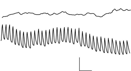 Figure 3 Recording of electrical activity from a segment of rabbit aorta. In the upper trace, recordings are made in normal solutions containing calcium. In the lower trace, fast rhythmic potentials become apparent after a change to calcium-free solution. Recordings are made with a pressure electrode. Calibration bar: 1 mV, 4 seconds. Reproduced with permission from Mangel A, van Breemen C. Rhythmic electrical activity in rabbit aorta induced by EGTA. J Exp Biol. 1981;90:339–342.Citation13