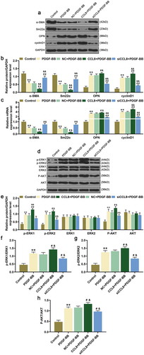 Figure 3. Effects of CCL8 on the expression of α-SMA, Sm22α, OPN, cyclinD1, p-ERK1/2, and p-AKT were detected by western blot and qRT-PCR. (a-b) Western blot assay was used to measure the protein expression level of α-SMA, Sm22α, OPN, and cyclinD1 in HASMCs stimulated by PDGF-BB after upregulating or silencing CCL8. **P < 0.01, vs. Control; #P < 0.05 and ##P < 0.01, vs. PDGF-BB; &P < 0.05 and &&P < 0.01 vs. NC+PDGF-BB. (c) The relative mRNA expressions level of α-SMA, Sm22α, OPN, and cyclinD1 in HASMCs stimulated by PDGF-BB after upregulating or silencing CCL8 was measured by qRT-PCR. **P < 0.01, vs. Control; &P < 0.05 and &&P < 0.01, vs. NC+PDGF-BB; #P < 0.05 and ##P < 0.01, vs. PDGF-BB. (d-e) Western blot assay was adopted to measure the protein expression levels of p-ERK1/2, ERK1/2, p-AKT as well as AKT in HASMCs stimulated by PDGF-BB after CCL8 upregulation or silencing. **P < 0.01, vs. Control; &P < 0.05 and &&P < 0.01, vs. NC+PDGF-BB; #P < 0.05 and ##P < 0.01, vs. PDGF-BB. (f) The phosphorylation level of ERK1 in HASMCs stimulated by PDGF-BB after upregulating or silencing CCL8 was detected by western blot. **P < 0.01, vs. Control; #P < 0.05, vs. PDGF-BB; &P < 0.05, vs. NC+PDGF-BB. (g) The phosphorylation level of ERK2 in HASMCs stimulated by PDGF-BB after upregulating or silencing CCL8 was determined by western blot. **P < 0.01, vs. Control; #P < 0.05, vs. PDGF-BB; &P < 0.05, vs. NC+PDGF-BB. (h) The phosphorylation level of AKT in HASMCs stimulated by PDGF-BB after upregulating or silencing CCL8 was quantified by western blot. **P < 0.01, vs. Control; #P < 0.05, vs. PDGF-BB; &P < 0.05, vs. NC+PDGF-BB. HASMCs: human aortic smooth muscle cells; PDGF-BB: platelet-derived growth factor BB; CCL8: C-C motif Chemokine ligand 8; NC: negative control.