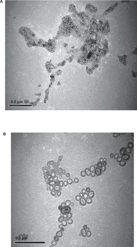 Figure 1 Transmission electron microscopic photograph of liposome A) Albendazole-loaded non-PEGylated or conventional liposomes and B) Albendazole-loaded PEGylated liposomes.