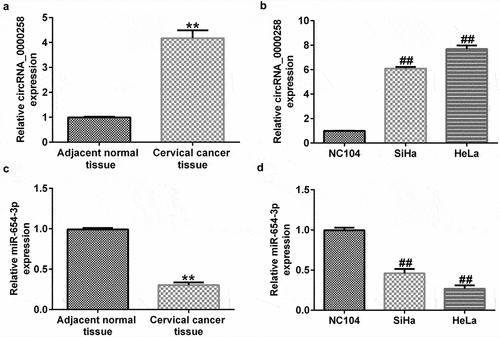 Figure 2. circRNA_0000258 expression levels are upregulated, while miR-654-3p are down-regulated in CC tissue and cells. (a) Levels of circRNA_0000258 in 30 CC and adjacent normal tissue samples assessed via RT-qPCR. (b) RT-qPCR analysis of circRNA_0000258 in SiHa, HeLa and NC104 cells. (c) Levels of miR-654-3p in 30 CC and adjacent normal tissues evaluated using RT-qPCR. (d) RT-qPCR analysis of miR-654-3p in SiHa, HeLa and NC104 cells analyzed using RT-qPCR. P < 0.05, **P < 0.01 vs. control.