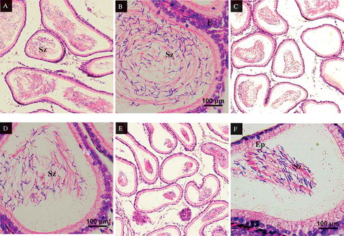 Figure 6. Epididymis cross-sections of rats, stained in H&E. (A) Epididymis of rats in control group, X100s. Epididymis layered by pseudostratified epithelium (Ep). A packed mass of spermatozoa (Sz) were seen in control group within the lumen of the epididymis. (B) Epididymis of rats in control group, X400. Epididymis layered by pseudostratified epithelium (Ep). A packed mass of spermatozoa (Sz) were seen in control group within the lumen of the epididymis. (C) Epididymis of rats in MSG60 group, X100. The epididymis showed reduced in spermatozoa (Sz) mass within the lumen. (D) Epididymis of rats in MSG120 group, X400. The epididymis showed reduced in spermatozoa (Sz) mass within the lumen. (E) Epididymis of rats in MSG120 group, X100. MSG 120 groups revealed reduced mass of spermatozoa (Sz) compared to MSG60 and control group. (F) Epididymis of rats in MSG120 group, X400. Alteration in epithelium (Ep) cells lining the epididymis in which nucleus appear irregular. Mass of spermatozoa (Sz) greatly reduced compared to MSG60 and control group.