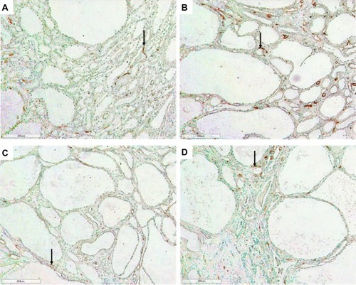 Figure 3 Photomicrographs of the renal outer medulla in LPK rats using RECA-1 immunostaining showing the loss of vasa recta with cyst expansion. (A) Week 3 (100x); (B) Week 6 (100x); (C) Week 12 (100x); (D) Week 24 (100x). Examples of limited areas of RECA-1 immunoreactivity are shown by arrows.