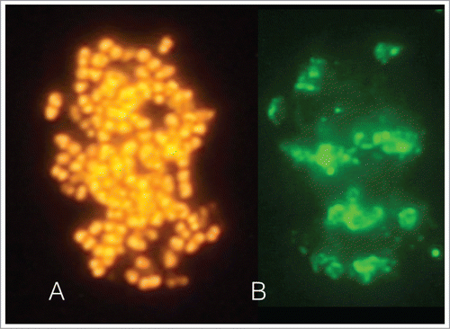 Figure 1. The images depict an intact biofilm-like fraction identified microscopically in a sample obtained from the apical region of tooth with a root canal infection. The sample was further processed in the laboratory. Fluorescence in situ hybridization (FISH) staining by the generic 16S rRNA oligonucleotide probe EUB-338 confirmed that it comprised of eubacteria (A). Immunofluorescence staining with the species-specific monoclonal antibody 326PM2 revealed the presence Parvimonas micra aggregates within this structure (B).