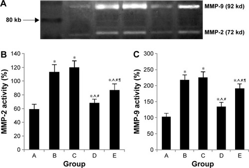 Figure 9 MMP-2 and MMP-9 activity.