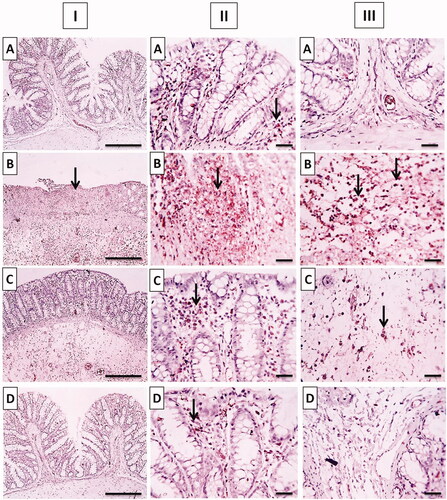 Figure 13. Photomicrographs of (I) whole colonic tissues, (II) mucosa, and (III) submucosa immunostained against TNF-α after acetic acid-induced colitis in rats. (A) Normal group; (B) positive control group; (C) TMB group; (D) TMB-NLC group. Magnification, ×100/scale bar = 100 μm (the whole section) and ×400/scale bar = 50 μm (the mucosal and submucosal parts). Positive stainings are shown by black arrows.