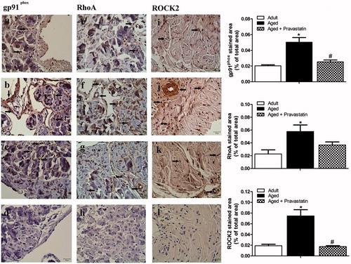 Figure 6. Representative photomicrographs for gp91phox (a–d), RhoA (e–h) and ROCK2 (i–l) immunohistochemistry in adult (a, e and i), aged (b, f and j) and aged treated with pravastatin (c, g and k) corpus cavernosum tissues. Insets in d, h and l represent the negative control immunostainings of gp91phox, RhoA and ROCK2, respectively. Arrows indicate gp91phox, RhoA and ROCK2 expressions in corpus cavernosum tissues. The graphs show image analysis results after immunohistochemistry. *p < 0.05 as compared with adult rats and #p < 0.05 as compared with aged rats.