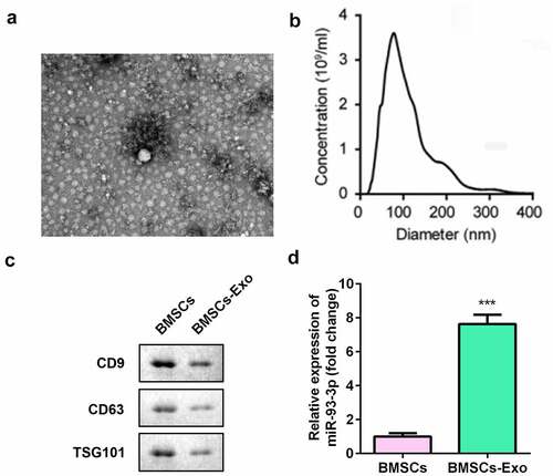 Figure 1. Isolation and characterization of BMSCs. (a) The morphology of exosomes (200 nm) was observed under TEM. (b) The particle size distribution and concentration in exosomes was analyzed by nanoparticle tracking analysis. (c) The protein expression of CD63, CD9, and TSG101 was measured by Western blot assay. (d) The qRT-PCR assay measures the expression of miR-93-3p. *** P < 0.001 vs. BMSCs
