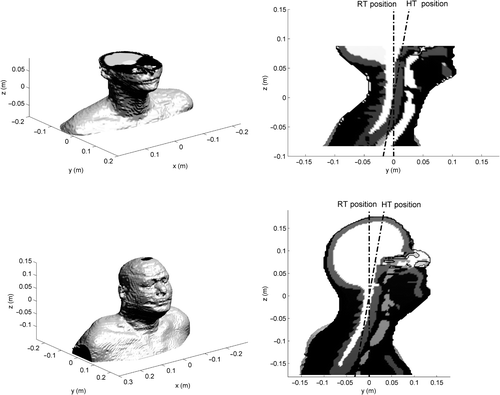 Figure 1. 3D view (a, c) and sagittal cuts (b, d) of the tissue distribution of the two head models. (b) and (d) show the RT position and an indication of the HT position (10° rotation).