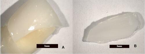 Figure 5 Cohesive failure in which the tooth structure is not damaged (A), only the porcelain is fractured (B).