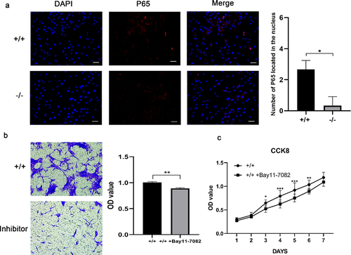 Figure 6. The proliferation and migration of EMSCs were slowed down by inhibition of NF-κB. (a) Immunofluorescence staining of P65 in p75NTR+/+ and p75NTR−/−EMSCs and the number of P65 in the nucleus. Almost no nucleic accumulation of P65 was demonstrated in p75NTR−/−EMSCs. (b) Transwell was used for analyzing the invasion of p75NTR+/+ and p75NTR+/+EMSCs with inhibitor. (c) CCK8 assay was used for detecting the proliferation of p75NTR+/+ and p75NTR+/+EMSCs with inhibitor. The data are presented as mean ± SD, n = 3, *P < 0.05, **P < .01, ***P < 001. Scale bar, 50 μm.