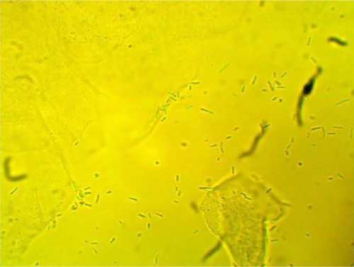 Figure 2 Clumping of lactobacilli with a matrix formation.