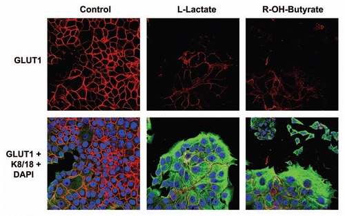 Figure 11 GLUT1 expression in MCF7 cells is downregulated by high energy metabolites. MCF7 cells alone were treated with L-Lactate (10 mM) and 3-Hydroxy-Butyrate (10 mM) for 2 d or left untreated. Note that treatment with either L-Lactate and 3-Hydroxy-Butyrate is sufficient to phenocopy the effects of fibroblasts on GLUT1 expression in co-cultured MCF7 cells, resulting in a loss of GLUT1 expression.