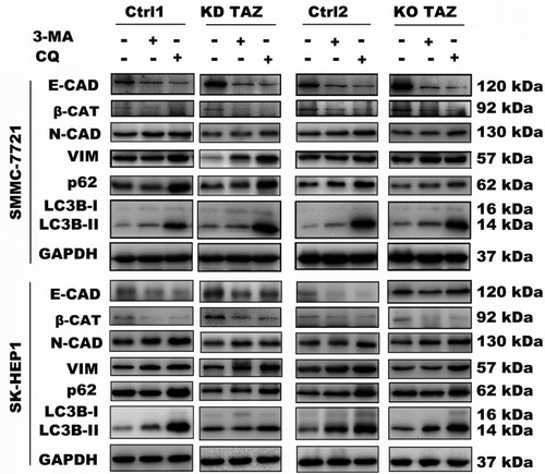 Figure 6 Effect of autophagy inhibition on the expression of the indicated genes in stable TAZ knockdown and knockout SMMC-7721 and SK-HEP1 cells.Notes: The indicated proteins in cellular extracts were determined by Western blot from SMMC-7721 and SK-HEP1 cells in the presence or absence of 3-MA (10 mM) or CQ (30 μM). GAPDH was used as a loading control. Representative blots are shown (n=3).Abbreviations: EMT, epithelial-mesenchymal transition; TAZ, transcriptional co-activator with PDZ-binding motif; 3-MA, 3-methyladenine; CQ, chloroquine; GAPDH, glyceraldehyde-3-phosphate dehydrogenase; E-CAD, E-cadherin; β-CAT, β-catenin; VIM, Vimentin; N-CAD, N-cadherin; KD TAZ, knockdown of transcriptional co-activator with PDZ-binding motif; KO TAZ, knockout of transcriptional co-activator with PDZ-binding motif; LC3B, microtubule-associated protein 1 light chain 3 beta.