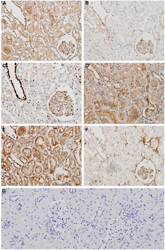 Figure 4 Representative micrographs of immunohistochemistry staining in the 5/6 Nx group rat renal cortex sections (400×).