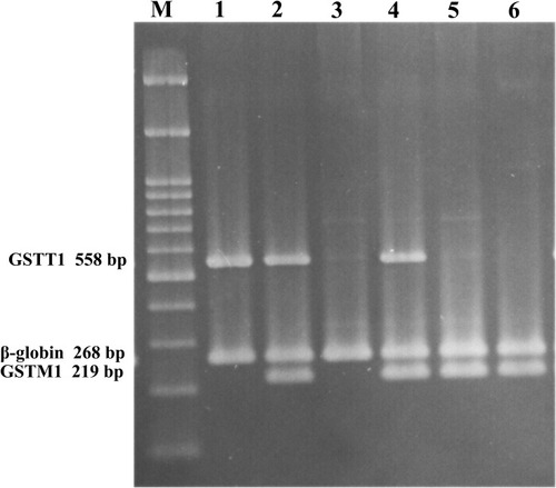Figure 2 Multiplex PCR products electrophoresed on 2% agarose gel. (M) 100 bp DNA ladder (CinnaGen co, Iran); lane 1: GSTM1 null & GSTT1 present; lanes 2 and 4: GSTM1 & GSTT1 present; lane 3: GSTM1 & GSTT1 null; lanes 5 and 6: GSTM1 present & GSTT1 null.