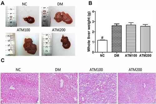 Figure 4 Effects of ATM on liver morphology in db/db mice as compared with responses in controls (NC). (A) Overall view of the liver. (B) Whole liver weights. (C) HE staining of the liver. Data are expressed as mean ± SEM (n =6). #indicates NC vs DM group p<0.05. Scale bar, 50 μm. (n = 6). Original magnification 200 ×.