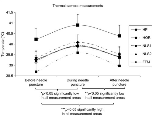 Figure 2 Thermal camera temperature changes.