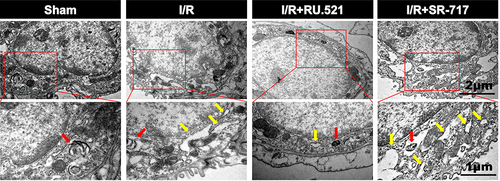 Figure 3 Electron micrographs showed the morphology of endoplasmic reticulum of alveolar epithelial type II cells in rats. Red arrow indicates the presence of lamellar bodies, which are characteristics of alveolar epithelial type II cells, yellow arrow notes swallowed and dilated endoplasmic reticulum. n = 3. Scale bar = 1μm or 2μm.