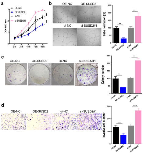 Figure 3. SUSD2 overexpression in Y79 cells promotes blood vessel formation of HUVECs in vitro. (a) Viability, (b) tube formation, (c) colony proliferation, and (d) migration of HUVECs after culture with conditioned medium of Y79 cells. ***P < 0.001.