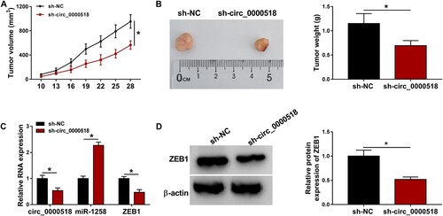 Figure 7. Circ_0000518 silencing suppresses BC progression in vivo. Xenograft tumor model was built using MCF-7 cells stably expressing sh-circ_0000518 or sh-NC. (A) Tumor volume was calculated every 3 d using the formula of width2 × length × 0.5, and tumor growth curve was then generated. (B) Tumors were resected and weighed after injection for 28 d. (C) RT-qPCR was applied to measure the expression of circ_0000518, miR-1258 and ZEB1 in resected tumor tissues. (D) Western blot assay was performed to analyze the protein level of ZEB1 in tumor tissues. *P < 0.05.