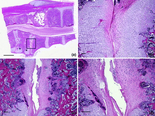 Figure 8.  Lesions in vertebral articular cartilage. 8a: Articular cartilage of the free thoracic vertebra is necrotic (box). Cartilage persists (*) in the ventral portions of the vertebra adjacent to the articular surface. Note the compression of the spinal cord. Bar = 20 mm. HE. 8b: A higher magnification of 8a from the region at the bottom and just below the box. The articular surface is irregular and a large mass of cartilage persists in this ventral portion of the free thoracic vertebra. Bar = 20 µm. HE. 8c: A higher magnification of the region within the box in 8a shows degeneration and necrosis of cartilage with an irregular surface. Osteomyelitis is in the bone beneath the cartilage on the right. Bar = 20 µm. HE. 8d: A higher magnification of 8c shows irregularity of the articular surface and streaks in the articular cartilage indicative of degeneration and necrosis. Bar = 200 µm. HE.