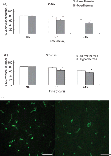 Figure 4. (A) The reduction of the number of laminin positive stain microvessels in the cortex. The microvessel numbers are expressed as percentage changes between the ipsilateral and contralateral hemispheres to the occluded MCA. *p < 0.01, **p < 0.001 compared with the normothermic group. (B) Number of laminin positive stain microvessels in the striatum. *p < 0.01, **p < 0.001, compared with the normothermic group. (C) Representative photomicrographs show microvessels stained by FITC-conjugated anti-laminin at 24 h after MCA occlusion in the cortex. Left panel: normothermic, right panel: hyperthermic (scale bar = 200 µm).