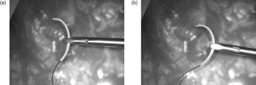 Figure 1. Examples of the ambiguity of needle pose perception. (a) Needle tip pointing towards the camera. (b) Needle tip pointing away from the camera.