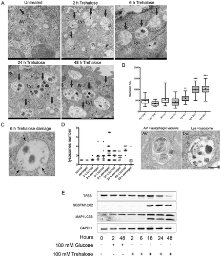 Figure 5. Electron microscopy analysis of trehalose effects on lysosome morphology. (a) NSC34 cells were treated with 100 mM trehalose for the indicated times and processed for electron microscopy. Lys, lysosome. Scale bar: 500 nm. (b) Quantification of the diameter of autophagic vesicles (AV) and lysosomes (Lys) in control (CTR) and trehalose-treated cells at different times. Examples of the morphology of the quantified organelles are shown below the graph. Scale bar: 200 nm. (c) High-scale magnification of an enlarged and damaged lysosome. Arrows point to gaps in the limiting membrane. Please note that the electron-dense material in the lysosomal lumen is sparse, a feature that is never observed in untreated cells. (d) Quantification of the number of lysosomes presenting gaps on their limiting membrane in control cells and cells treated as indicated (*p < 0.05, *** p < 0.001 non-parametric one-way ANOVA with Kruskal-Wallis test). (e) WB analysis was performed on NSC34 cells treated with 100 mM trehalose or glucose (as control) for different time periods.