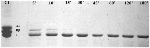 Figure 4. Degradation pattern of fibrinogen by xylarinase. Lane 1: fibrinogen, lanes 3–10: degradation products after 5, 10, 15, 30, 45, 60, 120 and 180 min incubation, respectively.