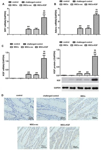 Figure 3 Expression of Adeno, SRY and KGF in intestinal tissue. Female SD rats were induced by TNBS to establish UC model, and then treated with MSCs, which untreated MSCs (MSCs), MSCs carrying empty vector (MSCs-vec) and MSCs carrying KGF gene (MSCs-KGF), respectively. UC rats in the Model group were treated with only DMEM medium. SD female rats treated without any intervention were used as a control group. After 1 week of treatment, the expression of Adeno (A) and SRY (B) in intestinal tissues was detected by qRT-PCR. At the same time, the expression of KGF mRNA and protein in the intestinal tissues of each group was examined by qRT-PCR and Western blot assay (C). (D) Immunohistochemistry images from the intestinal tissues of rats for KGF. Scale bar = 50 μm. n=10. Data shown are mean±SD. ##p<0.01vs Model group; $$p<0.01vs MSCs group.