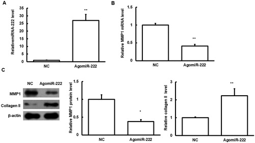 Figure 6. Effects of agomiRNA-222 transfection on HNPC cells.Note: HNPC cells were transfected with agomiRNA-222. (A) The expression levels of miRNA-222 were detected. (B) The mRNA expression levels of MMP1 in these cells were detected with quantitative real-time PCR. (C) The protein expression levels of MMP1 and type II collagen in these cells were detected with Western blot analysis. Compared with the NC group, *p < 0.05, **p < 0.01.