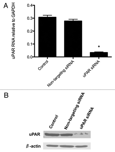 Figure 2 qRT-PCR (A) and western blot (B) analyses of uPAR expression in BCPAP control cells, non-targeting (NT) siRNA transfectants and uPAR siRNA transfectants. Cells were grown in Accell delivery media for at least 72 hours with the appropriate siRNA oligonucleotides as described in Materials and Methods. uPAR mRNA levels are expressed as a fraction relative to GAPDH expression (i.e., 2−ΔCt). *indicates a significant (p < 0.05) decrease in uPAR mRNA levels relative to control or NT-siRNA-transfected BCPAP cells. Data shown are representative of three experiments.