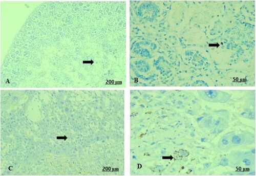 Figure 11. (A–D) Light photomicrograph of sections from foetal kidney (A, B) and placenta (C, D) of the pregnant female by Bax immunostaining. Light section of (A) shows control kidney of minimal reaction of Bax in the tubules. Photomicrograph of (B) shows GAE received kidney with moderate expression of Bax inside the renal tubules. Light section of (C) shows control placenta of fair immunoreactivity of the villi towards Bax. Light section of (D) shows GAE received placenta expressed strong positive expression of Bax protein.