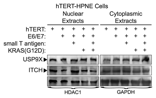 Figure 5. USP9X and ITCH expression in transformed, nestin expressing human pancreatic cell lines. Cell lines were immortalized by expression of the indicated proteins (e.g., hTERT, E6/E7, small T-antigen, KRAS-G12D), as described previously.Citation40 Expression of USP9X and ITCH were examined by western blot analysis. HDAC1 and GAPDH served as loading controls.