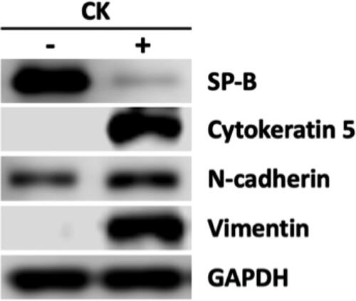 Figure 9. iAT2 cells treated with cytokines expressed mesenchymal proteins. iAT2 cells were treated with cytokine cocktail every other day for 2 wk. The loss of AT2 marker SP-B and expression of cytokeratin 5, N-cadherin, and vimentin were consistent with transdifferentiation toward a basal cell or myofibroblast phenotype and expression of mesenchymal markers. The band intensities, after being normalized to GAPDH, indicated a 6.9-fold decrease in SP-B and 1.2-fold increase in N-cadherin. The increases in cytokeratin 5 and vimentin were not calculated because they are barely detectable in the cells not treated with cytokines.